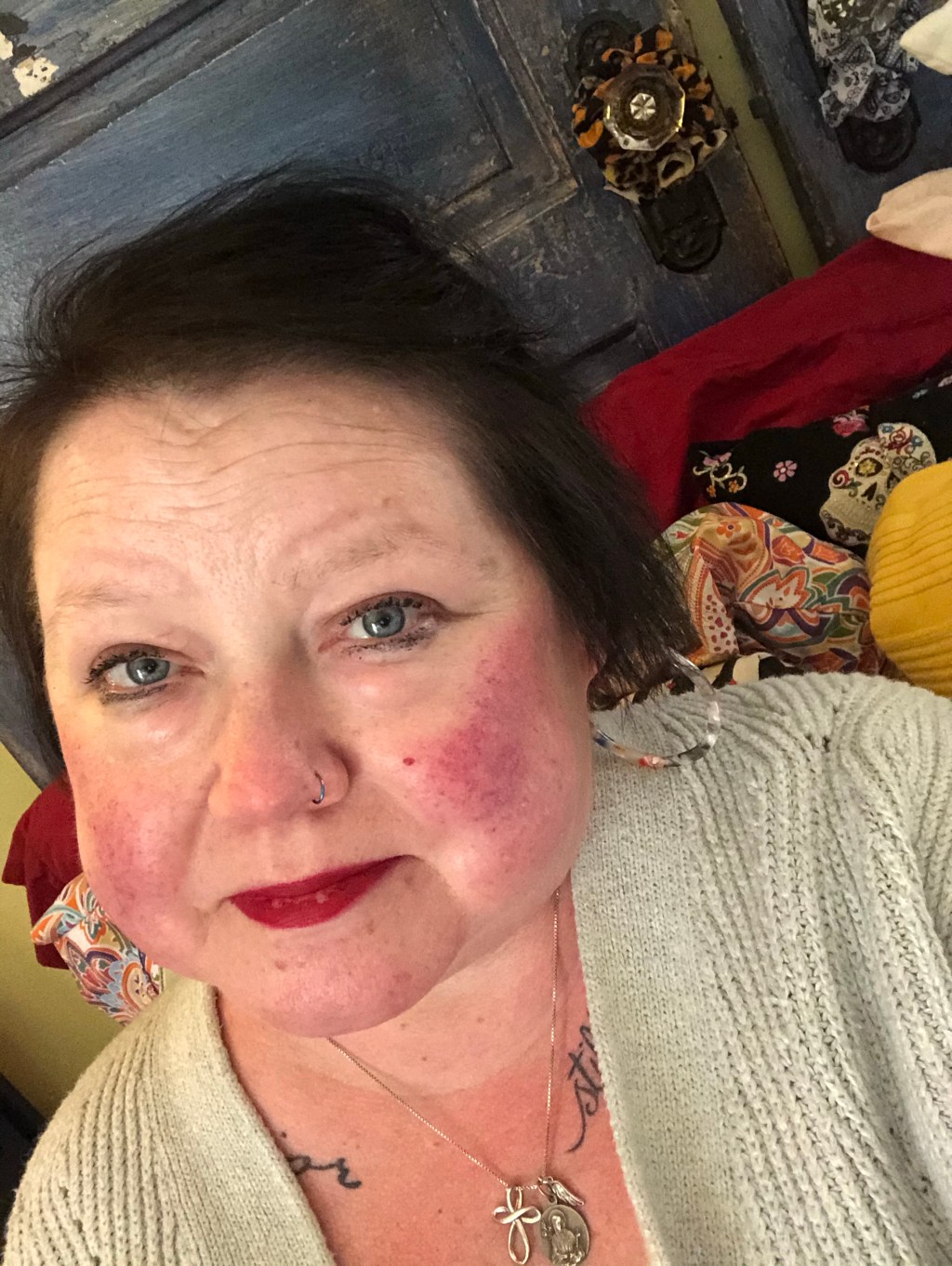 chronic pain, being treated like garbage as a patient, and Hell’s own flare on the horizon. .&nbsp;.