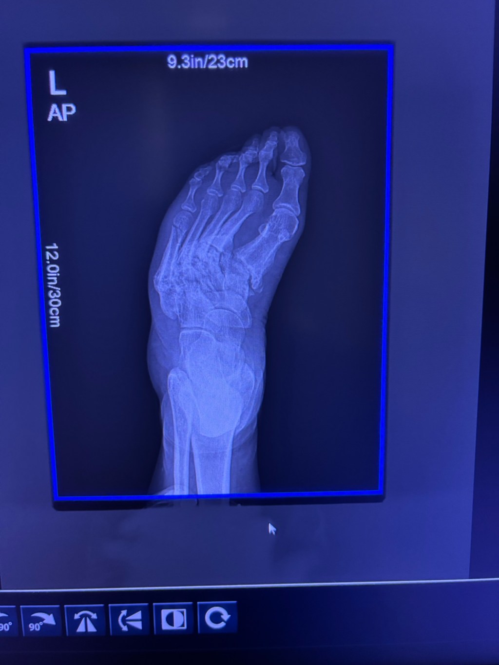 Blogmas Day 2 – A Merry Ortho&nbsp;Christmas.